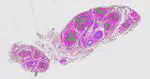 Spatial transcriptomics VN human sural nerve.